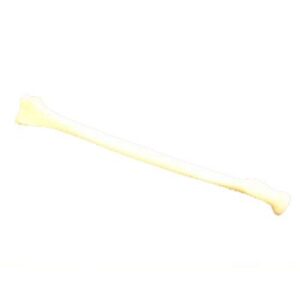 Radius Bone Model