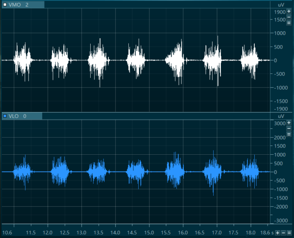 Noraxon Ultium Wireless Surface EMG - Image 8