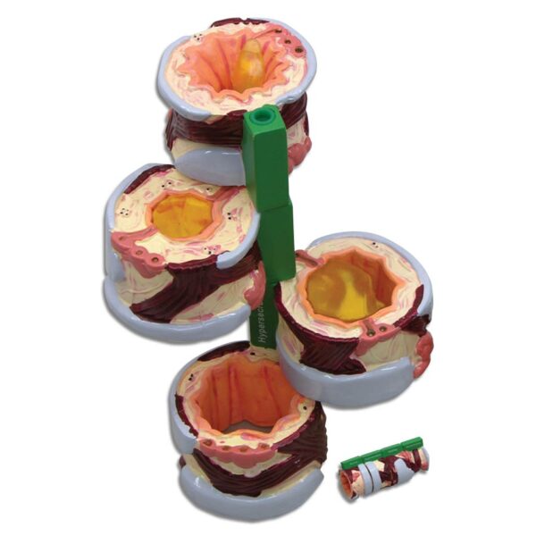 4-Piece Bronchus - Budget Model
