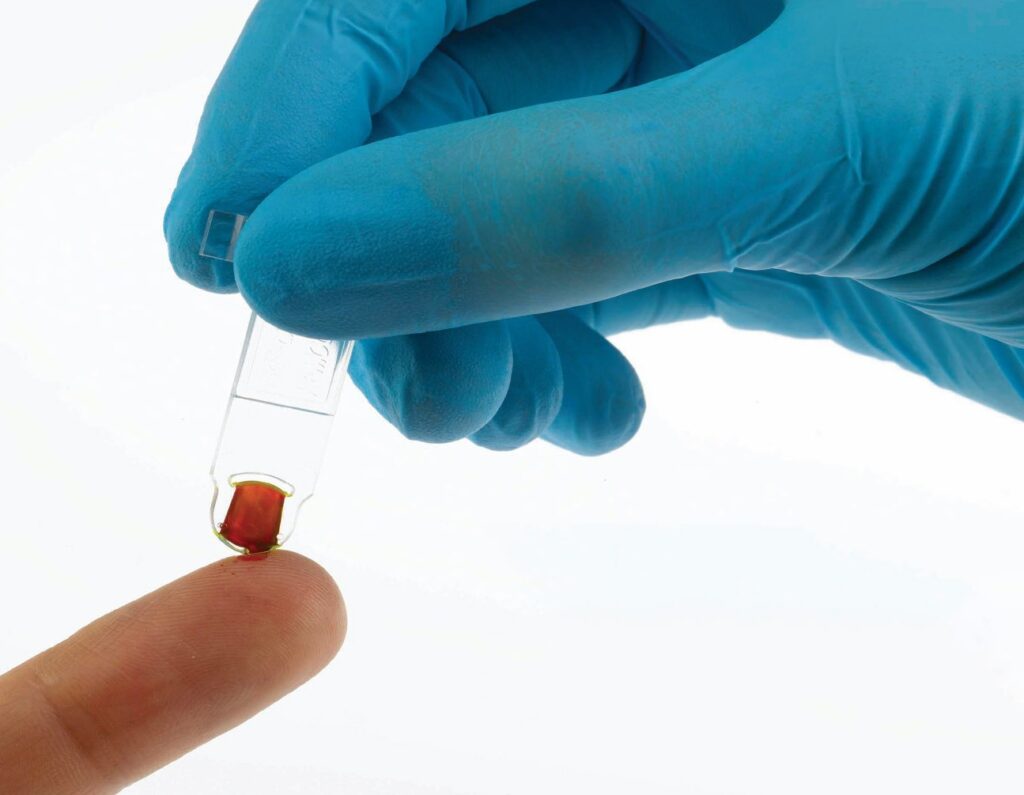 EKF Diagnostics Hemo Control Microcuvette HaB Direct