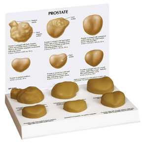 Prostate-set of 6 Budget Model