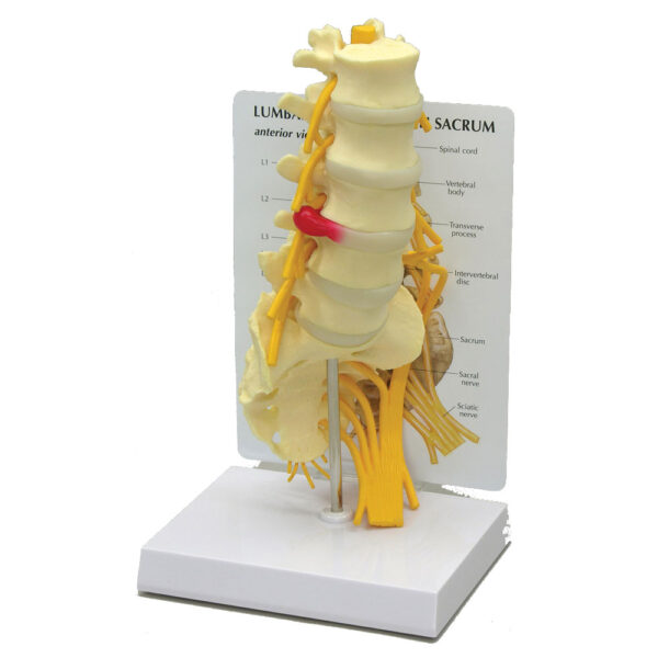 5-Pc. Lumbar Vertebrae with Sacrum - Budget Model