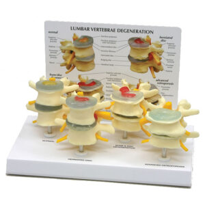 Four Stage Vertebrae - Budget Model