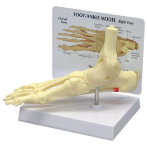 Ankle/Foot - Plantar Fasciitis - Budget Model