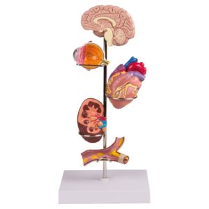 Hypertension Model, 7-Part