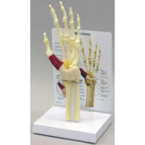Hand/Wrist - Carpal Tunnel Syndrome - Budget Model