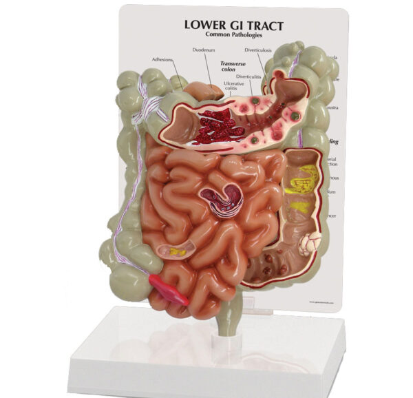 GI Tract - Budget Model
