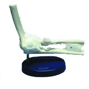 Elbow Joint Ligamented